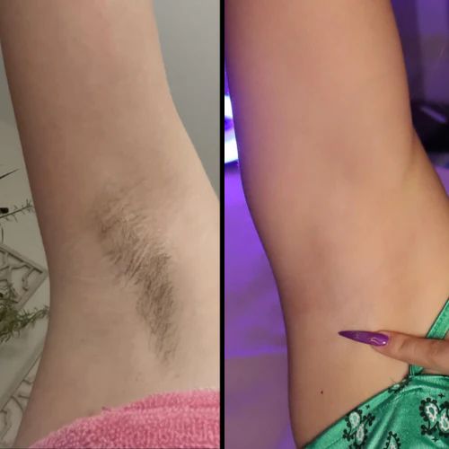 Body Hair Removal Cream