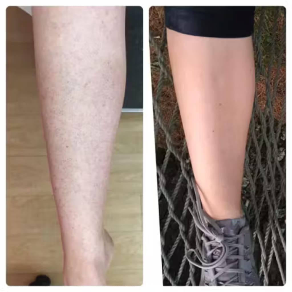 Body Hair Removal Cream