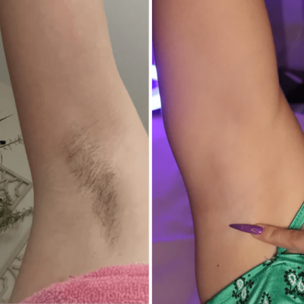 Hair Removal Cream