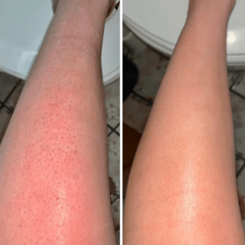 Hair Removal Cream
