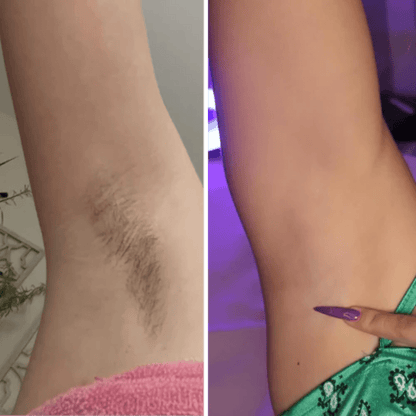 Hair Removal Cream