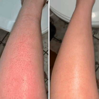Hair Removal Cream